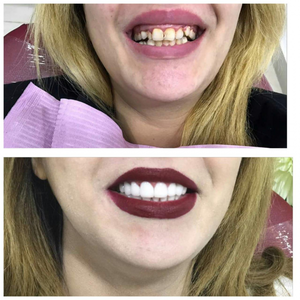 https://wa.me/message/RTOG2IPDOBEMI1