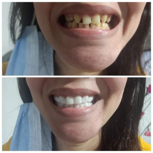 https://wa.me/message/RTOG2IPDOBEMI1