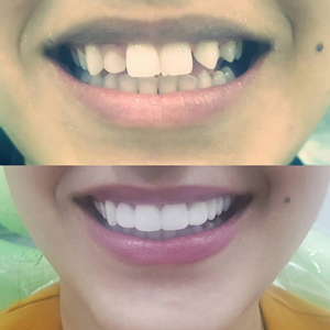 https://wa.me/message/RTOG2IPDOBEMI1