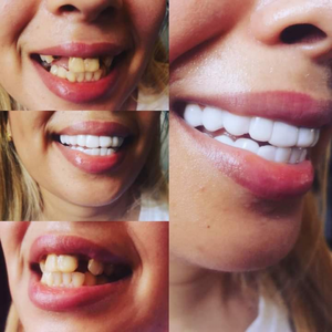 https://wa.me/message/RTOG2IPDOBEMI1