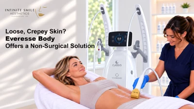 Everesse Body: Non-Surgical Solution for Loose, Crepey Skin