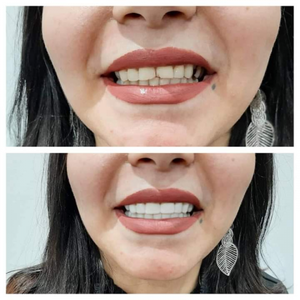 https://wa.me/message/RTOG2IPDOBEMI1
