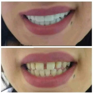 https://wa.me/message/RTOG2IPDOBEMI1