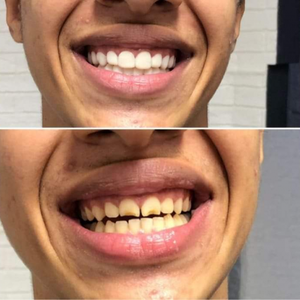 https://wa.me/message/RTOG2IPDOBEMI1