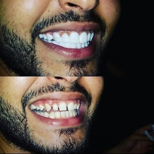 https://wa.me/message/RTOG2IPDOBEMI1