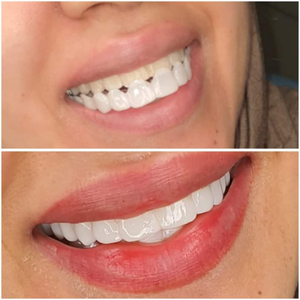 https://wa.me/message/RTOG2IPDOBEMI1