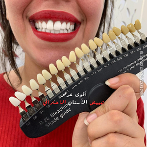 https://wa.me/message/RTOG2IPDOBEMI1