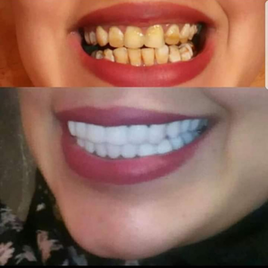 https://wa.me/message/RTOG2IPDOBEMI1