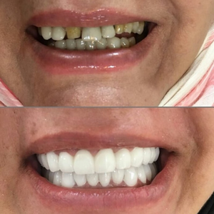 https://wa.me/message/RTOG2IPDOBEMI1