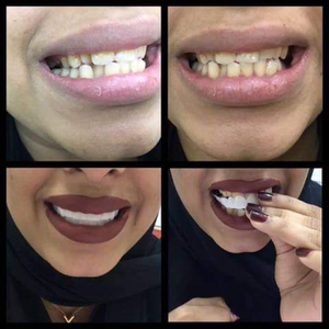 https://wa.me/message/RTOG2IPDOBEMI1