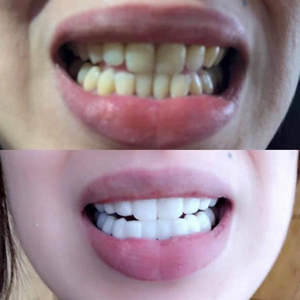 https://wa.me/message/RTOG2IPDOBEMI1