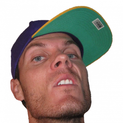 SKWEEZY