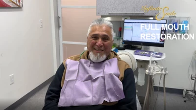 ⭐ Full Mouth Restoration Testimonial Video