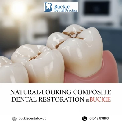 Natural-Looking Composite Dental Restoration in Buckie