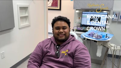 ⭐ Root Canal and Crown Testimonial Video: