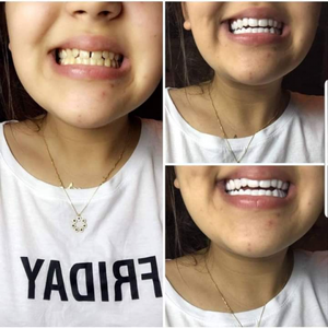 https://wa.me/message/RTOG2IPDOBEMI1
