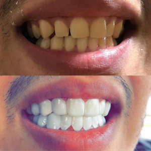 https://wa.me/message/RTOG2IPDOBEMI1