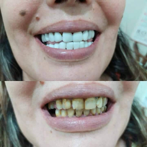 https://wa.me/message/RTOG2IPDOBEMI1