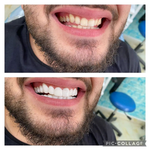 https://wa.me/message/RTOG2IPDOBEMI1