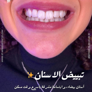 https://wa.me/message/RTOG2IPDOBEMI1