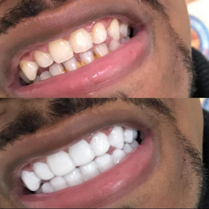 https://wa.me/message/RTOG2IPDOBEMI1