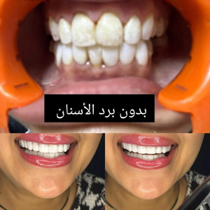 https://wa.me/p/4402811776424918/212680008215
