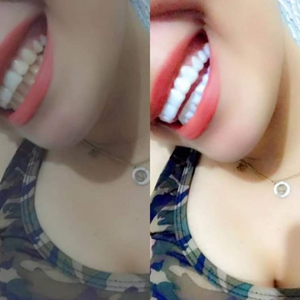 https://wa.me/message/RTOG2IPDOBEMI1