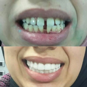 https://wa.me/message/RTOG2IPDOBEMI1